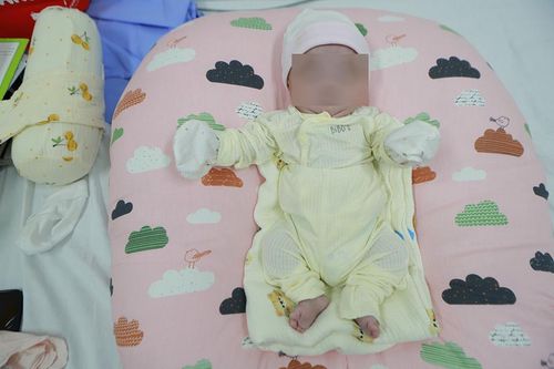 Nuôi sống bé sinh non nặng 400g, lọt thỏm bằng bàn tay bác sĩ