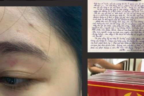 Vụ 2 nhân viên quán bánh mì đánh khách: Hướng dẫn bị hại đi giám định