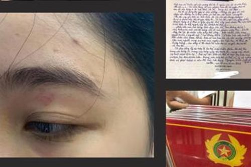 Nhân viên bánh mì Nguyên Sinh hành hung khách: Chuyển hồ sơ lên Công an quận