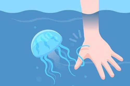 Lưu ý khi đụng phải sứa biển