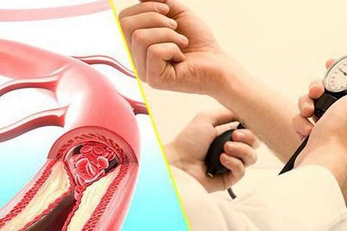Nắng nóng, người bị tăng huyết áp cần biết điều này để phòng nguy hiểm