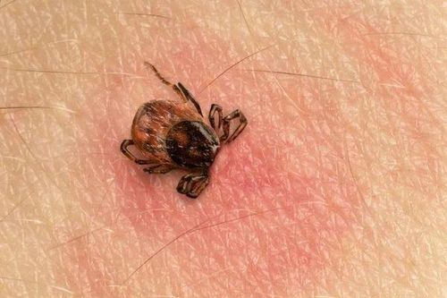 Nguy cơ sốt mò gia tăng trở lại