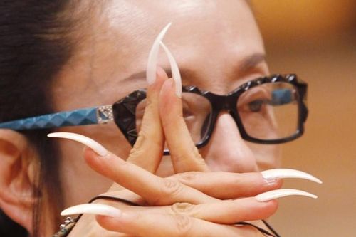 'Chim công làng múa' không thể tự tắm, mặc quần áo vì móng tay quá dài