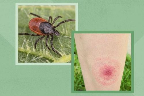 10 bệnh lý lây truyền từ bọ ve cần cẩn trọng