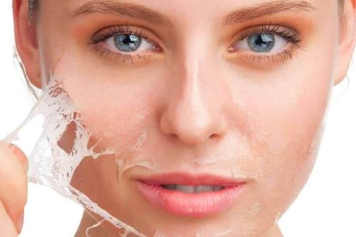 Những lưu ý quan trọng khi peel da vào mùa hè