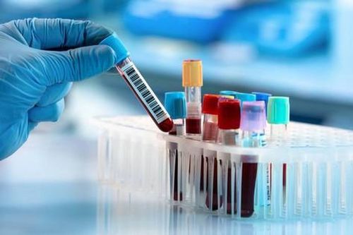 Bộ Y tế: Các tỉnh, thành thanh kiểm tra, xử lý cơ sở xét nghiệm không đảm bảo về an toàn sinh học
