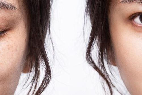 Loại kem dưỡng da nào giúp chị em trẻ hóa da hiệu quả không cần phẫu thuật?