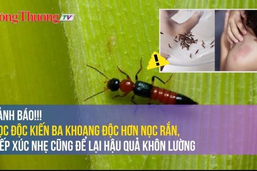 Cảnh báo: Nọc kiến ba khoang độc hơn nọc rắn, tiếp xúc nhẹ cũng để lại hậu quả khôn lường