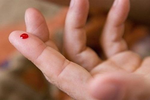 Suýt chết vì lấy kim chọc đầu ngón tay và tai để bỏ 'máu độc' chữa tai biến