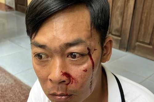 Điều tra vụ việc người đàn ông bị hành hung khi vừa rời trụ sở Tòa án