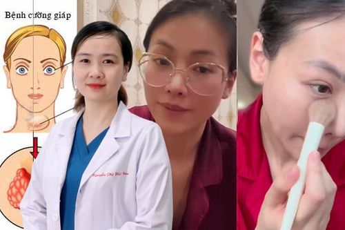 Bệnh cường giáp của hoa hậu Phương Khánh có gây ra nhiều biến chứng nguy hiểm?