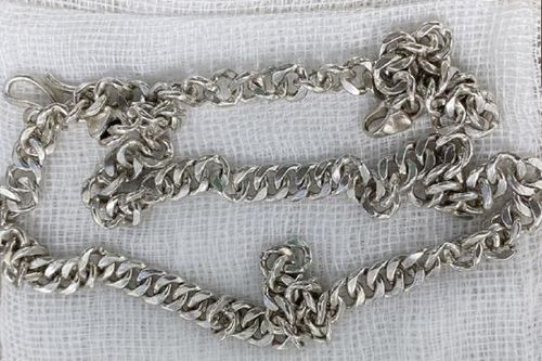 Bé gái 6 tuổi nuốt sợi dây chuyền 'khủng' vào bụng