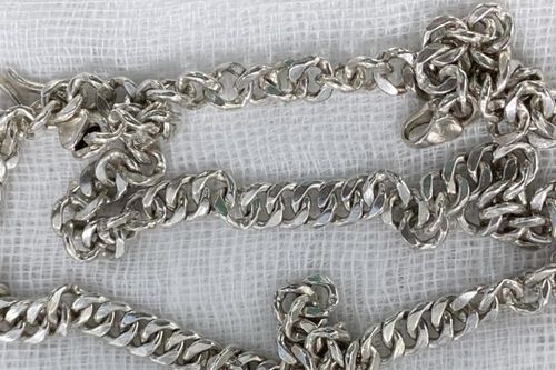 Bé trai 6 tuổi nuốt trọn sợi dây chuyền bạc vào bụng