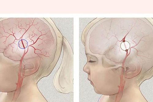 Người phụ nữ nguy cơ tử vong cao do mắc bệnh hiếm gặp trên thế giới