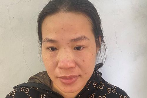 Nữ giáo viên mầm non ở Hà Tĩnh bị cấm đi khỏi nơi cư trú