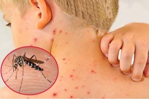 6 bệnh giao mùa thường gặp ở trẻ nhỏ, cha mẹ lưu ý để giúp con phòng tránh