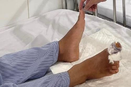 Nam thanh niên suýt mất 2 ngón chân khi vận hành máy nghiền mùn