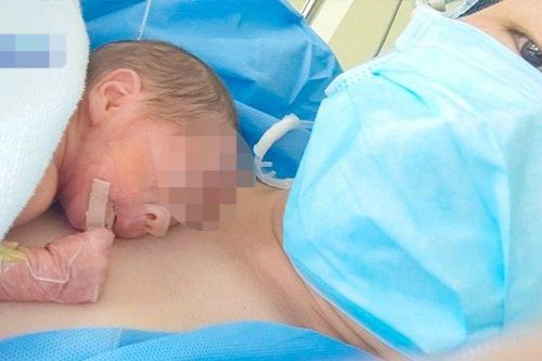 Trẻ sống kỳ tích sau 2 tháng ở cùng bào thai lưu