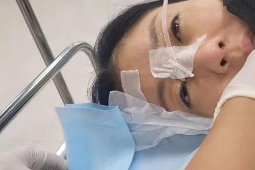 Showbiz 13/7: Nữ ca sĩ cấp cứu vì tổn thương giác mạc khi quay phim