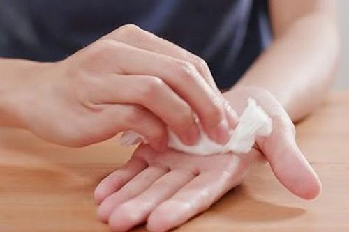 Cách ngăn ngừa ra mồ hôi tay, chân quá nhiều