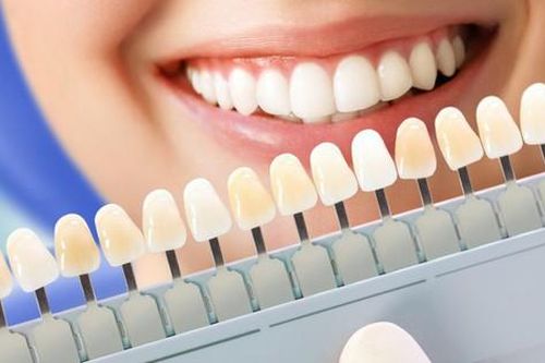 Răng bị ố vàng có tẩy trắng được không?