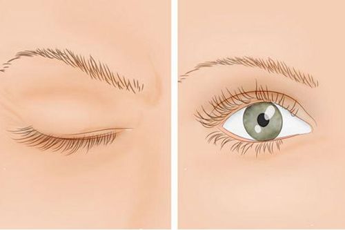 Liên tục nháy giật mắt có thể là lời cảnh báo sớm của 4 vấn đề bệnh tật