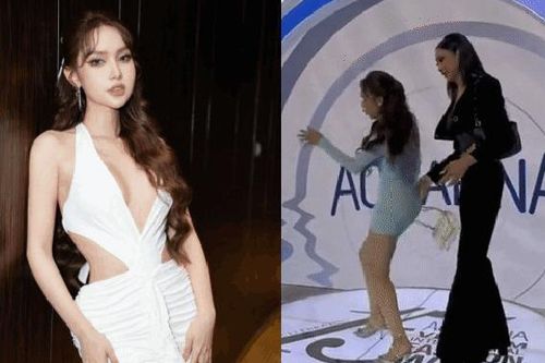 Mỹ nhân ngã sõng soài tại sự kiện, chân bầm tím sau tai nạn nhớ đời