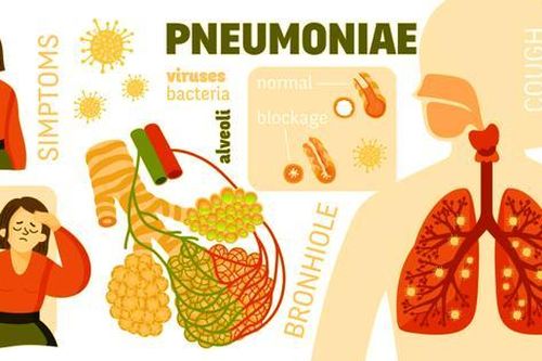 Cảnh báo viêm phổi ở trẻ em do vi khuẩn M.pneumoniae gây biến chứng