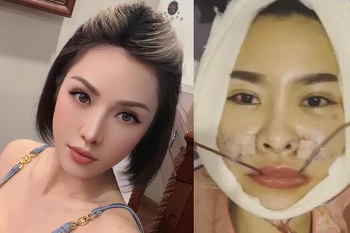 Nhan sắc Quế Vân sau khi 'đập đi xây lại' gương mặt