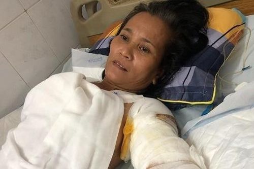 Bị bỏng điện phải cắt cụt 2 cánh tay, mẹ nghèo lo lắng tương lai 2 con nhỏ