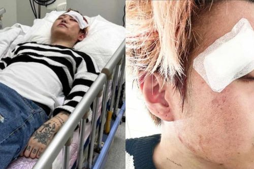 Xôn xao nam ca sĩ lên cơn động kinh đến ngất xỉu, phải hủy bỏ đêm diễn