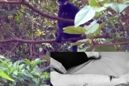 Một người dân ở Bắc Kạn bị Voọc đen má trắng tấn công