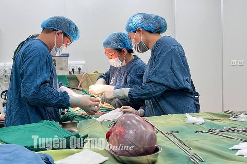 Phẫu thuật thành công khối u buồng trứng to tương đương với thai 5 tháng