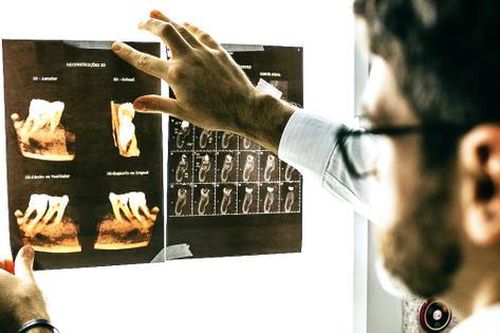 Nhà khoa học Nhật Bản phát triển thuốc kích thích mọc răng mới