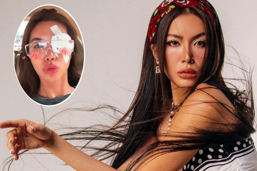 Minh Tú lại gặp sự cố ở mắt sau tai nạn phải may 10 mũi tại cằm