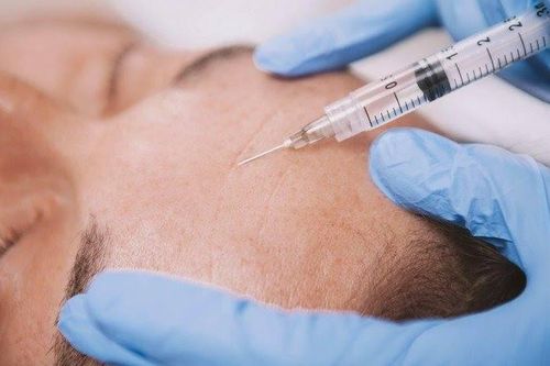 Tiêm filler tại điểm bán bánh mì xôi, chàng trai 21 tuổi nhập viện sau 5 phút