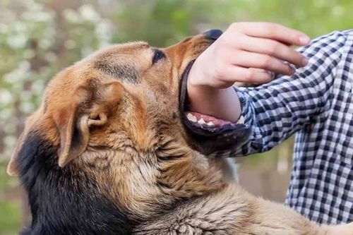 Đang ngồi nhà chơi, bé 5 tuổi bất ngờ bị chó xông vào nhà cắn rách mặt