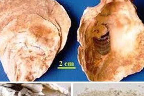 Bài thuốc chữa mồ hôi ra quá nhiều