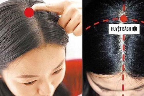 4 huyệt vị giúp làm giảm chứng chóng mặt