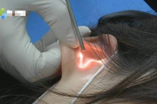 Bị điếc tai sau nụ hôn say đắm