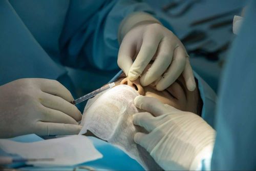 Bác sĩ nói gì về thông tin cô gái nâng mũi bằng sụn tai của bạn trai?