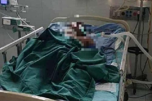 Đi lấy tổ ong để mưu sinh, người đàn ông phải trả giá bằng cả tính mạng