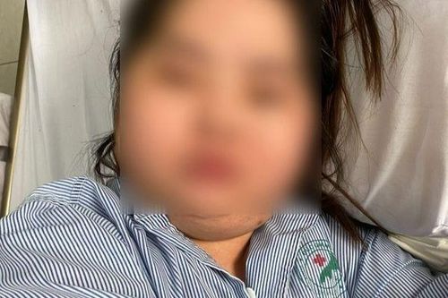 Mặt và bụng to bất thường, cô gái trẻ ngỡ ngàng vì mắc bệnh hiếm gặp