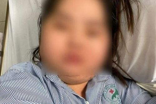 Mặt và bụng bỗng to lên bất thường, cô gái 26 tuổi bất ngờ phát hiện mắc bệnh hiếm