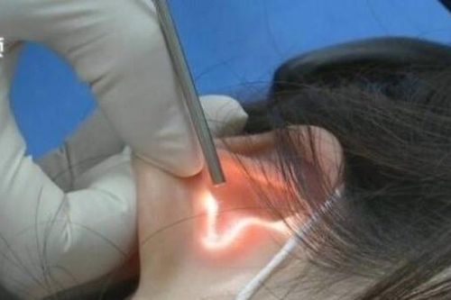 Cô gái bị thủng màng nhĩ sau nụ hôn quá mạnh của bạn trai