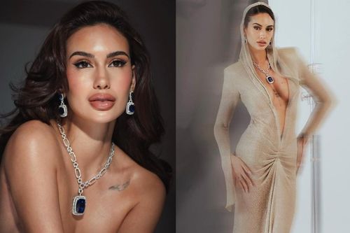 Hoảng sợ đôi môi sưng 'như ong đốt' của hoa hậu 'nóng bỏng' nhất Philippines