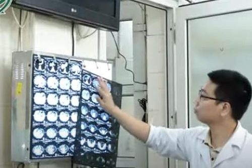 Viêm gan: Những ca bệnh biến chứng đáng sợ