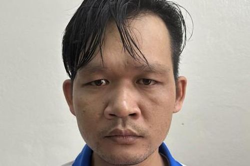 Bị chồng tạt axit vào mặt, người vợ nguy cơ mù 2 mắt vĩnh viễn