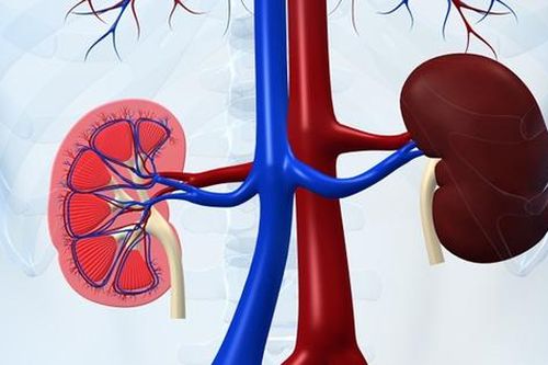 Hội chứng viêm cầu thận là gì?
