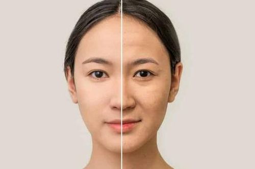 Nguyên nhân gây lão hóa da sớm và cách ngăn chặn